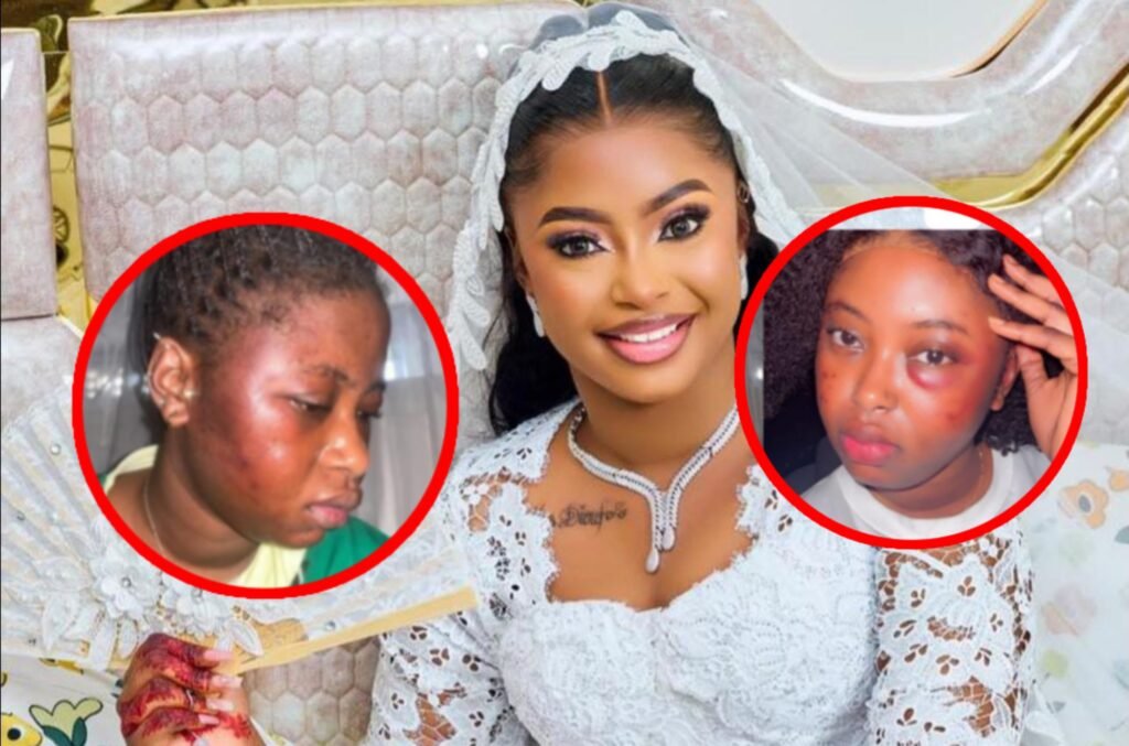 le calvaire de Bousso, mariée depuis septembre, entre coups, maraboutage et pressions financières