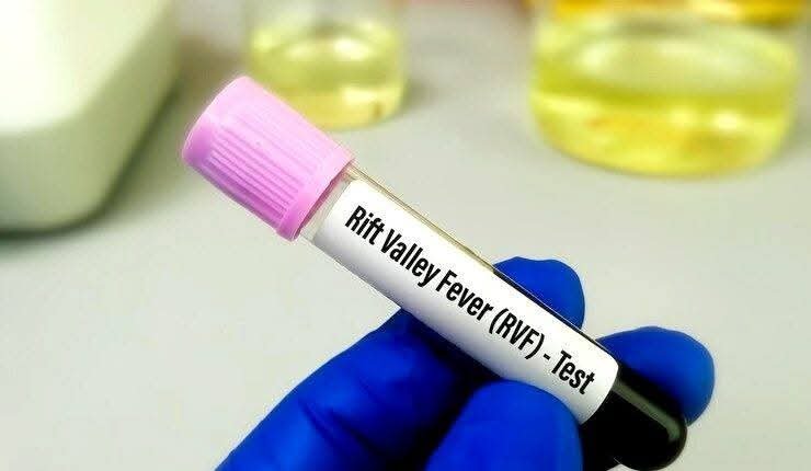 12 nouveaux cas enregistrés, le bilan grimpe à 343 contaminations